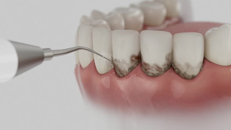 Trusted Tooth Extraction service in Shell Point, SC - Dentist Open Now